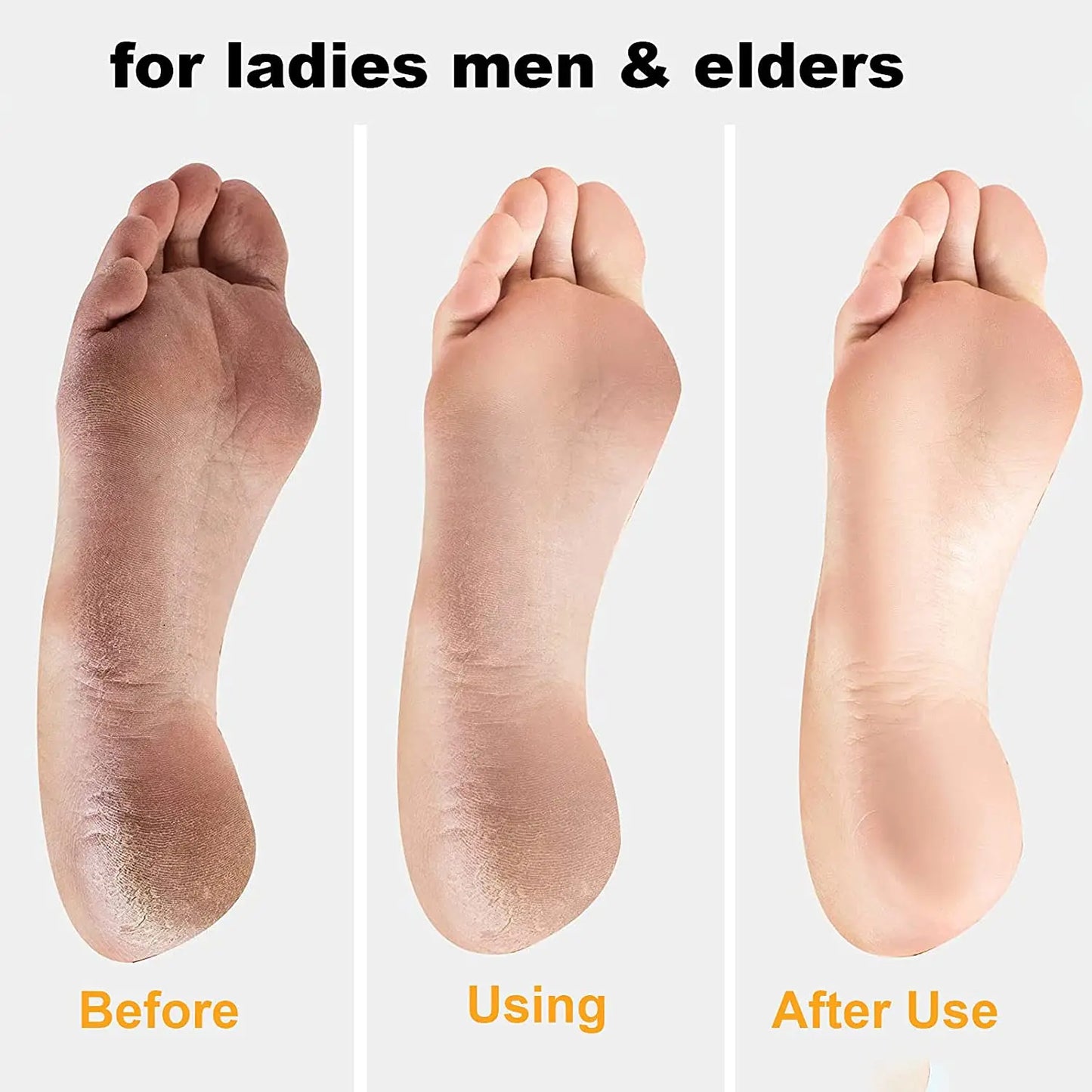 Pedicure Heel Scratcher Files